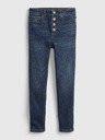 GAP Gyerek jeggings high rise farmer GAP
